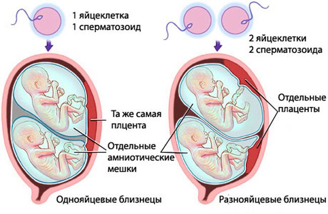 Различия близнецов