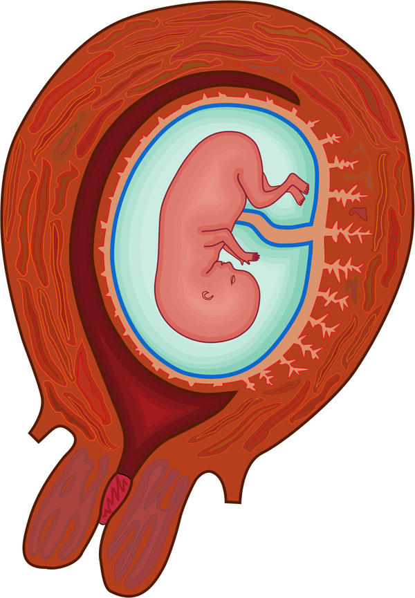 нарушение кровообращения между будущей матерью и ребенком