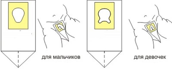 Как собирать мочу у новорожденных мальчика и девочки