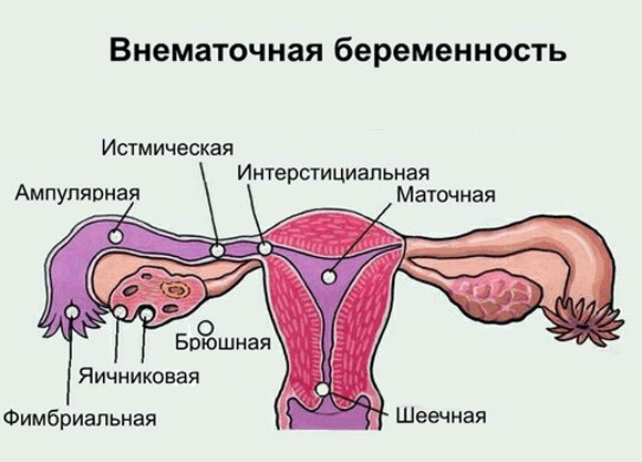 варианты прикрепления зародыша