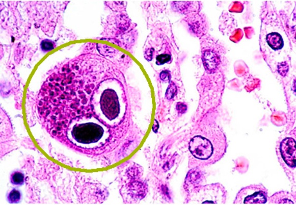Где обнаруживается цитомегаловирус