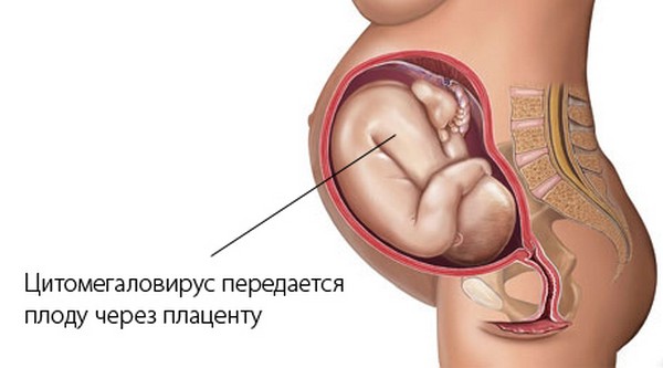 ПрепаратЫ для лечения ЦМВ