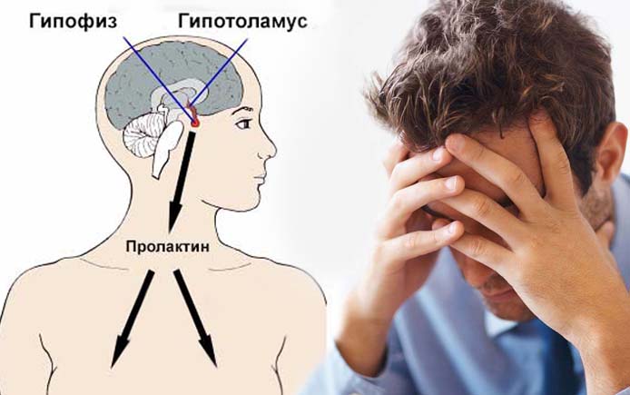 Почему повышается уровень пролактина у мужчин