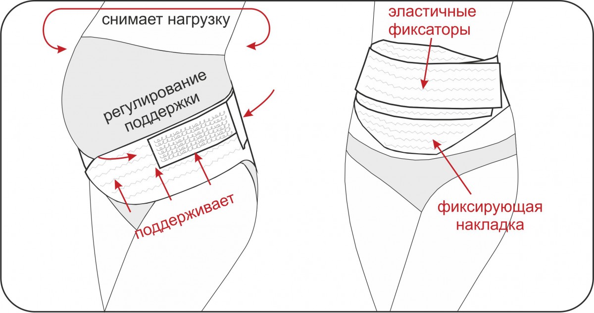 Рекомендации как носить бандаж