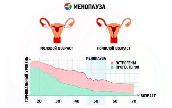 гормоны в менопаузе