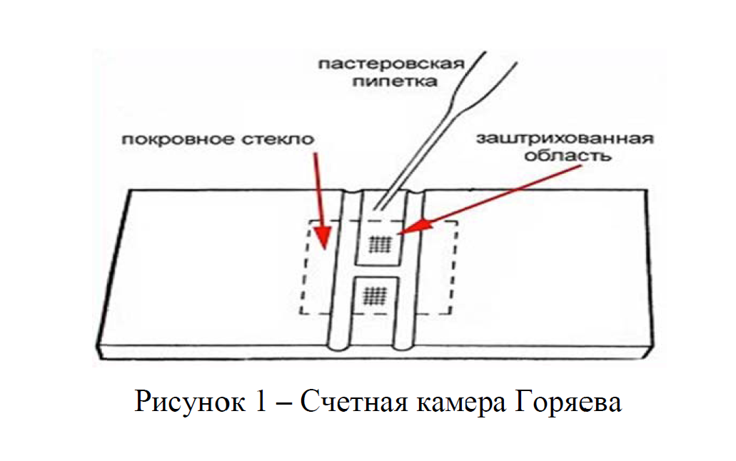 так выглядит камера Горяева